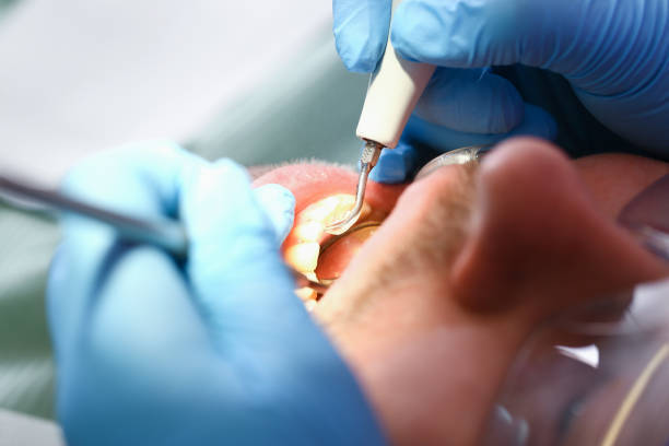 Best Urgent Tooth Repair  in Marceline, MO