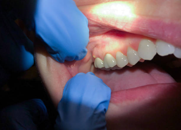 Best Dentist for Dental Trauma  in Marceline, MO